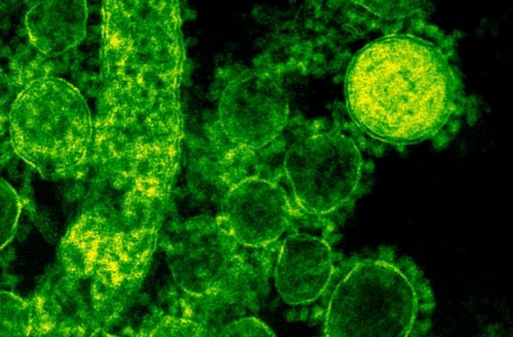 Six people die & 648 suffer from scrub typhus since January 2021 in Himachal Scrub typhus