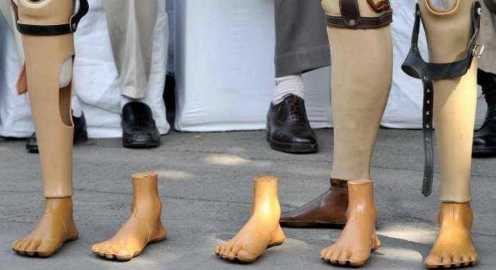 Special artificial limbs fitment camps to be organised from 1st to 16th December Special artificial limbs fitment camps to be organised from 1st to 16th December HIMACHAL HEADLINES