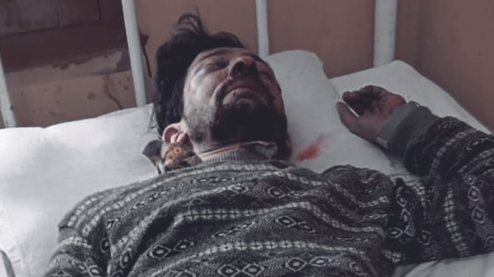 HRTC Driver & Conductor brutally beaten on Holi in Junga - both under treatment in IGMC HRTC Driver & Conductor brutally beaten on Holi in Junga - both under treatment in IGMC HIMACHAL HEADLINES