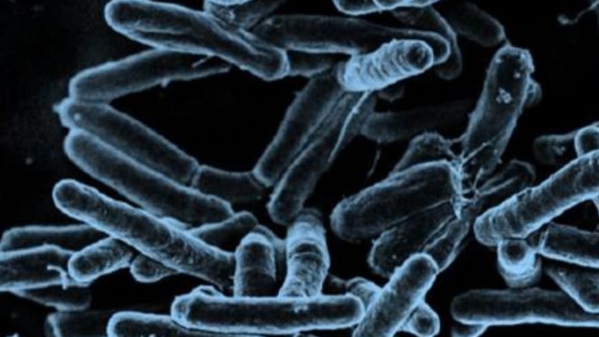 Intestinal TB on the rise in Himachal’s young adults: IGMC Study urges early diagnosis for better recovery Intestinal TB on the rise in Himachal’s young adults: IGMC Study urges early diagnosis for better recovery HIMACHAL HEADLINES