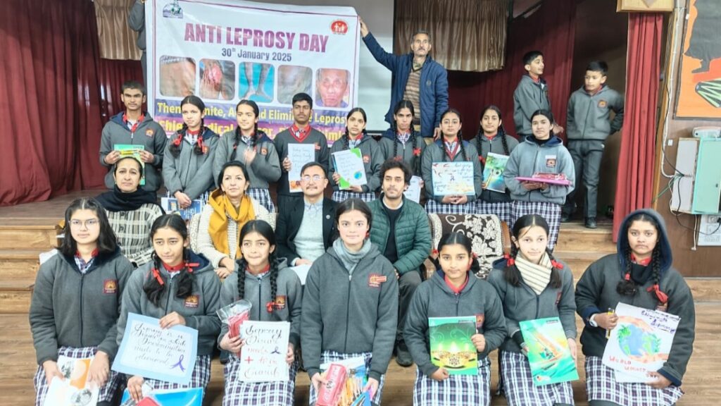 Leprosy is treatable and its treatment is available free of cost in government hospitals Leprosy is treatable and its treatment is available free of cost in government hospitals HIMACHAL HEADLINES
