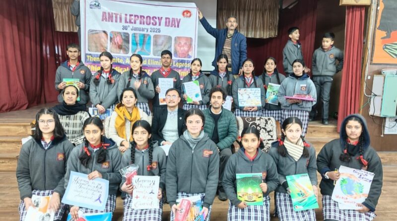 Leprosy is treatable and its treatment is available free of cost in government hospitals Leprosy is treatable and its treatment is available free of cost in government hospitals HIMACHAL HEADLINES