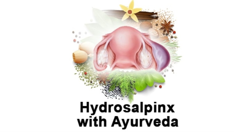 Ayurvedic treatment for infertility due to hydrosalpinx HIMACHAL HEADLINES