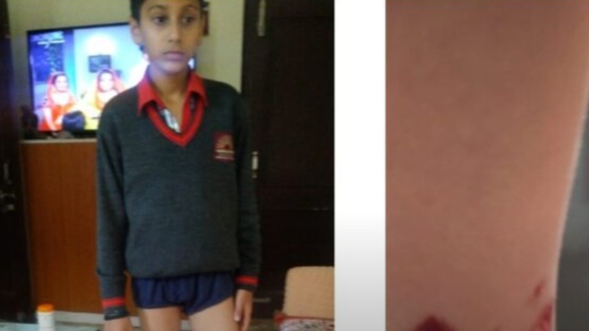 A City on Edge: Shimla's Children Are Not Safe From Rampant Stray Dogs A City on Edge: Shimla's Children Are Not Safe From Rampant Stray Dogs HIMACHAL HEADLINES